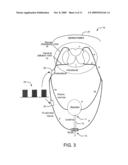 System and Method of Bladder and Sphincter Control diagram and image