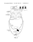 System and Method of Bladder and Sphincter Control diagram and image