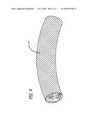 CUSTOMIZABLE VERTEBRAL REPLACEMENT ASSEMBLY SYSTEM diagram and image