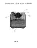 System and method for trapezium bone replacement diagram and image