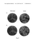 Biofilm-Inhibiting Catheters and Tubings diagram and image