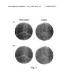 Biofilm-Inhibiting Catheters and Tubings diagram and image