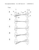 Method of chiropractic treatment diagram and image