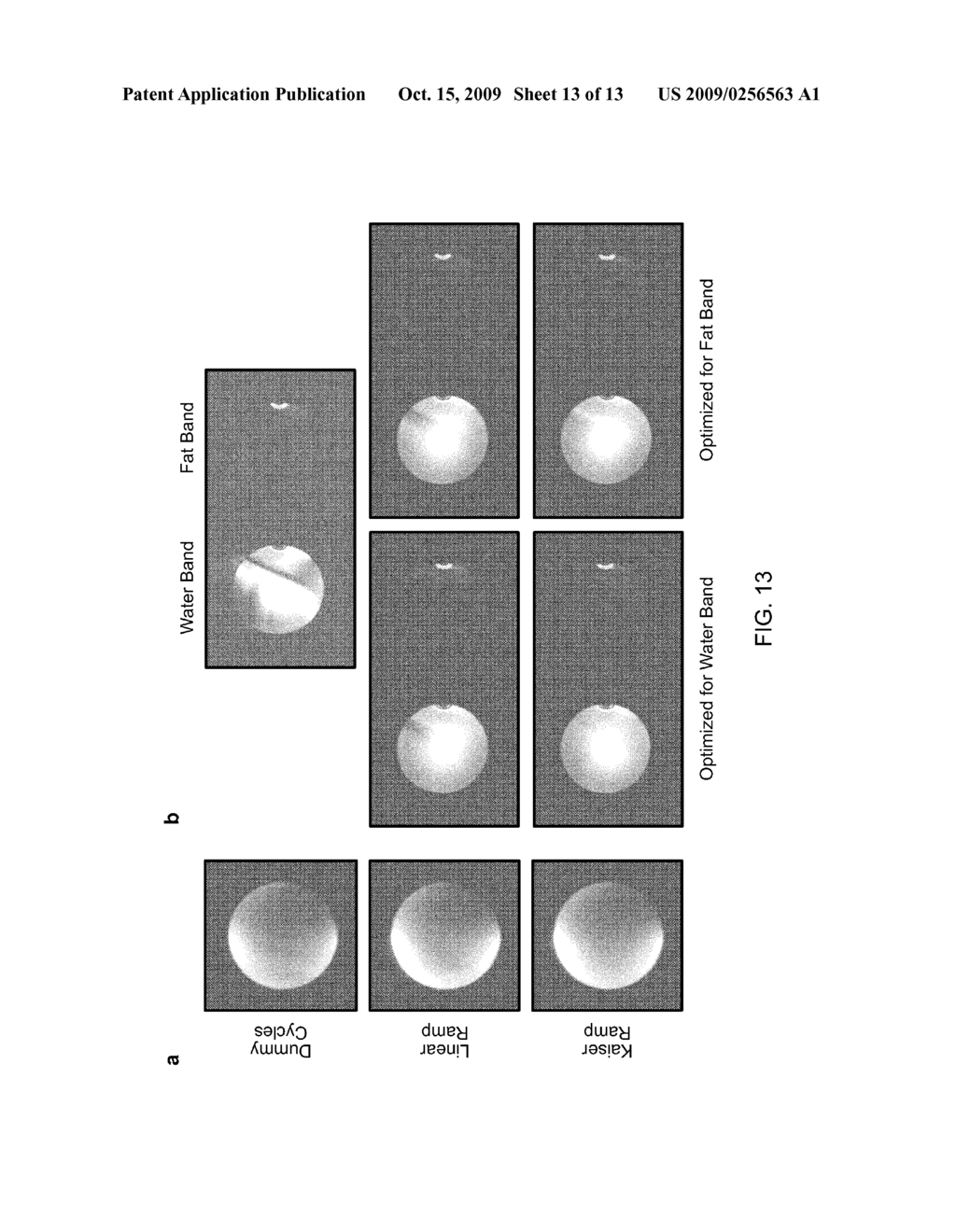 PREPARING THE MAGNETIZATION STATE OF A SAMPLE FOR ALTERNATING REPETITION TIME STEADY STATE FREE PRECESSION MAGNETIC RESONANCE IMAGING - diagram, schematic, and image 14