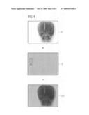 Method and facility for visualizing an overlaid presentation of x-ray images diagram and image