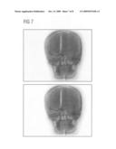 Method and facility for visualizing an overlaid presentation of x-ray images diagram and image