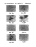 NGR receptor and methods of identifying tumor homing molecules that home to angiogenic vasculature using same diagram and image