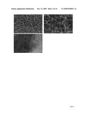 Microbes Encapsulated Within Crosslinkable Polymers diagram and image