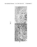 Delivery of LFA-1 antagonists to the gastrointestinal system diagram and image