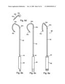 Method of Treating Dental Periapical Lesions diagram and image