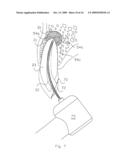 Method of Treating Dental Periapical Lesions diagram and image