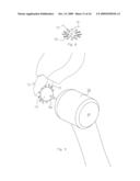 Method of Treating Dental Periapical Lesions diagram and image