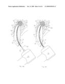 Method of Treating Dental Periapical Lesions diagram and image