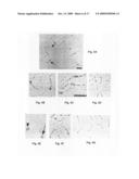 Prokaryotic collagen-like proteins and uses thereof diagram and image