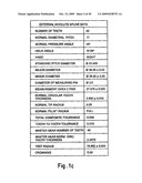 Automatic Transmission and Gear Train diagram and image