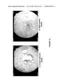 CHIMERIC AND HUMANIZED ANTIBODIES TO alpha5beta1 INTEGRIN THAT MODULATE ANGIOGENESIS diagram and image