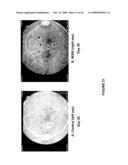 CHIMERIC AND HUMANIZED ANTIBODIES TO alpha5beta1 INTEGRIN THAT MODULATE ANGIOGENESIS diagram and image