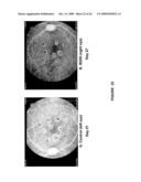 CHIMERIC AND HUMANIZED ANTIBODIES TO alpha5beta1 INTEGRIN THAT MODULATE ANGIOGENESIS diagram and image