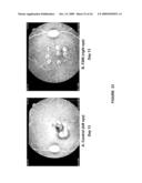 CHIMERIC AND HUMANIZED ANTIBODIES TO alpha5beta1 INTEGRIN THAT MODULATE ANGIOGENESIS diagram and image