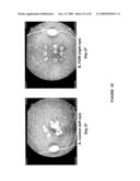 CHIMERIC AND HUMANIZED ANTIBODIES TO alpha5beta1 INTEGRIN THAT MODULATE ANGIOGENESIS diagram and image