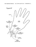 METHODS AND DEVICES TO DECREASE TISSUE TRAUMA DURING SURGERY diagram and image