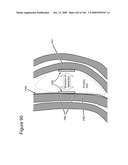 METHODS AND DEVICES TO DECREASE TISSUE TRAUMA DURING SURGERY diagram and image