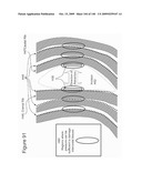 METHODS AND DEVICES TO DECREASE TISSUE TRAUMA DURING SURGERY diagram and image