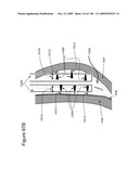 METHODS AND DEVICES TO DECREASE TISSUE TRAUMA DURING SURGERY diagram and image