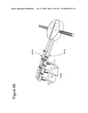 METHODS AND DEVICES TO DECREASE TISSUE TRAUMA DURING SURGERY diagram and image