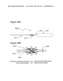 METHODS AND DEVICES TO DECREASE TISSUE TRAUMA DURING SURGERY diagram and image