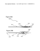 METHODS AND DEVICES TO DECREASE TISSUE TRAUMA DURING SURGERY diagram and image