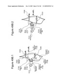 METHODS AND DEVICES TO DECREASE TISSUE TRAUMA DURING SURGERY diagram and image