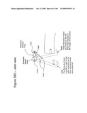 METHODS AND DEVICES TO DECREASE TISSUE TRAUMA DURING SURGERY diagram and image