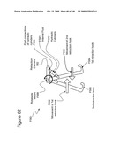 METHODS AND DEVICES TO DECREASE TISSUE TRAUMA DURING SURGERY diagram and image