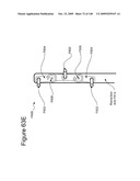 METHODS AND DEVICES TO DECREASE TISSUE TRAUMA DURING SURGERY diagram and image