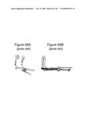 METHODS AND DEVICES TO DECREASE TISSUE TRAUMA DURING SURGERY diagram and image