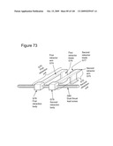 METHODS AND DEVICES TO DECREASE TISSUE TRAUMA DURING SURGERY diagram and image