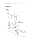 METHODS AND DEVICES TO DECREASE TISSUE TRAUMA DURING SURGERY diagram and image