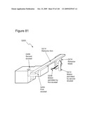 METHODS AND DEVICES TO DECREASE TISSUE TRAUMA DURING SURGERY diagram and image