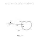 Surgical Access System and Related Methods diagram and image