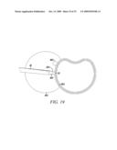 Surgical Access System and Related Methods diagram and image