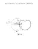 Surgical Access System and Related Methods diagram and image