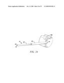 Surgical Access System and Related Methods diagram and image