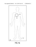 OPTICAL TOMOGRAPHY MEASUREMENT USING AN ADAPTED BRIM FOR THE RECEIVING VOLUME diagram and image