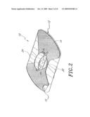 DIALYSIS CATHETER ANCHORING SYSTEM diagram and image