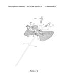 DIALYSIS CATHETER ANCHORING SYSTEM diagram and image