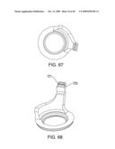 IMPLANTABLE INJECTION PORT AND PROTECTIVE CAP diagram and image