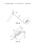 IMPLANTABLE INJECTION PORT AND PROTECTIVE CAP diagram and image