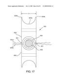 CATHETERS WITH LUBRICIOUS LININGS AND METHODS FOR MAKING AND USING THEM diagram and image