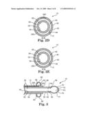 METHOD, APPARATUS AND KITS FOR FORMING STRUCTURAL MEMBERS WITHIN THE CARDIAC VENOUS SYSTEM diagram and image